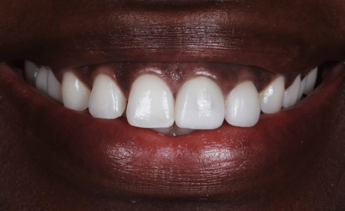 After -Bond Dental London