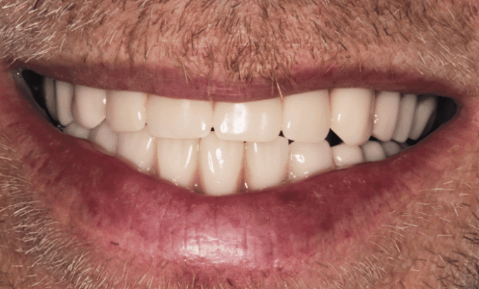 After -Bond Dental London