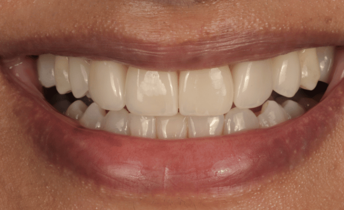 After -Bond Dental London