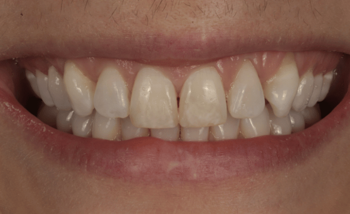 Before - Bond Dental London