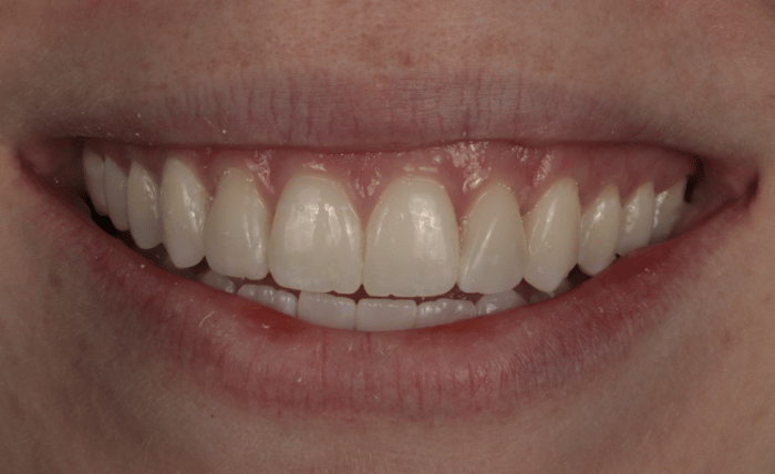 After -Bond Dental London