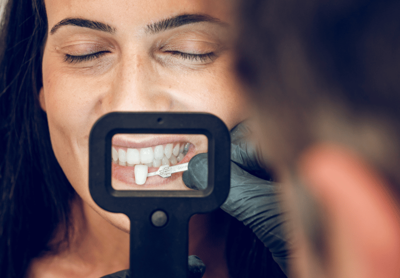 Blog -Bond Dental London